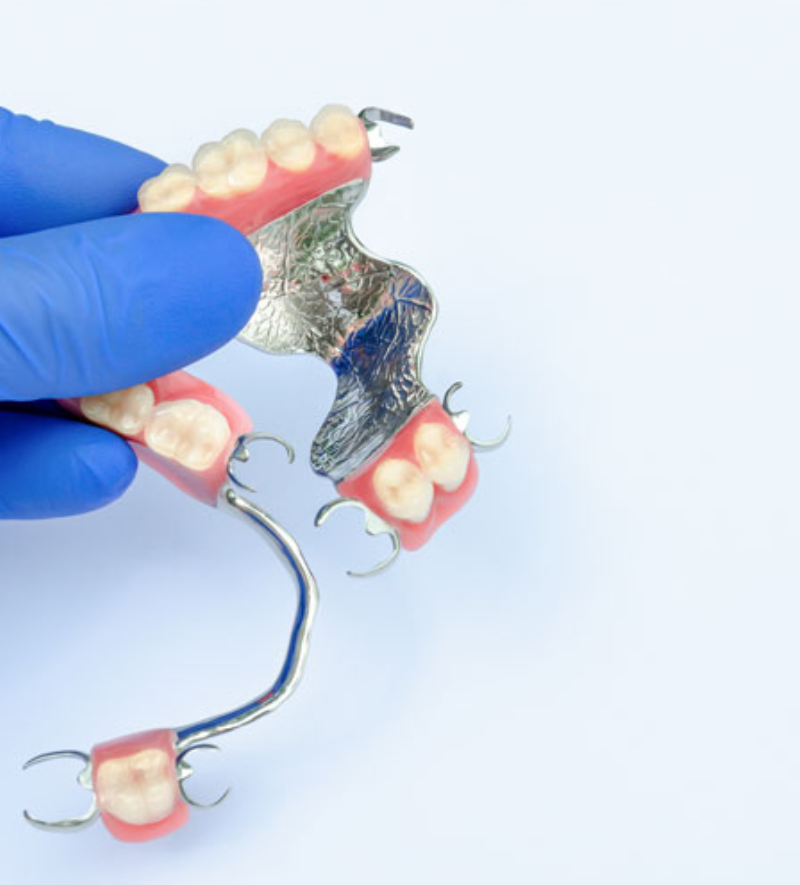 Partial Dentures<br />